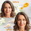 Anti-Aging Face Pearls